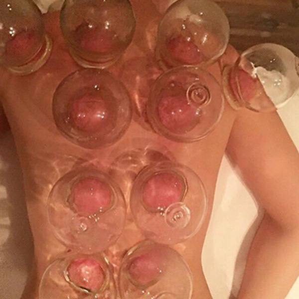 Terapia de Ventosas Chinas Shalo Smart Training